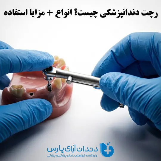 رچت ایمپلنت چیست؟