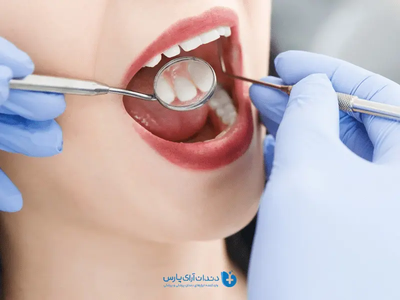 سوند دندانپزشکی