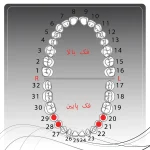 تصویر راهنمای انتخاب کلمپ رابردم