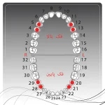 تصویر راهنمای انتخاب کلمپ رابردم