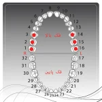 تصویر راهنمای انتخاب کلمپ رابردم