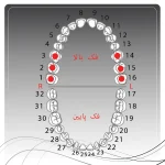 تصویر راهنمای انتخاب کلمپ رابردم