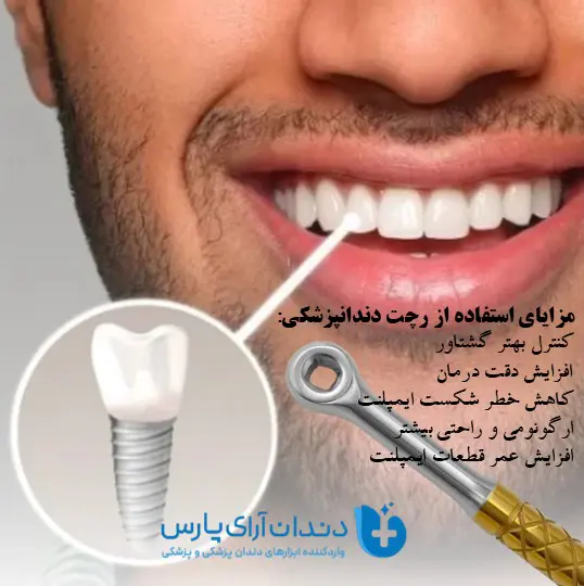 مزایای استفاده از رچت ایمپلنت